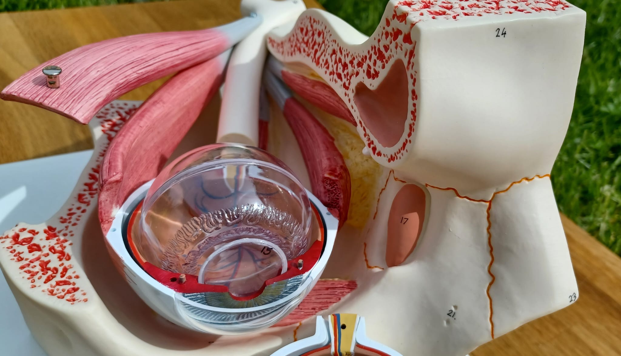 Modellauge mit knöcherner Augenhöhle